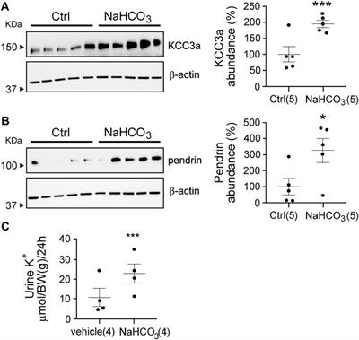 KCC3a, a Strong Candidate Pathway for K+ Loss in Alkalemia